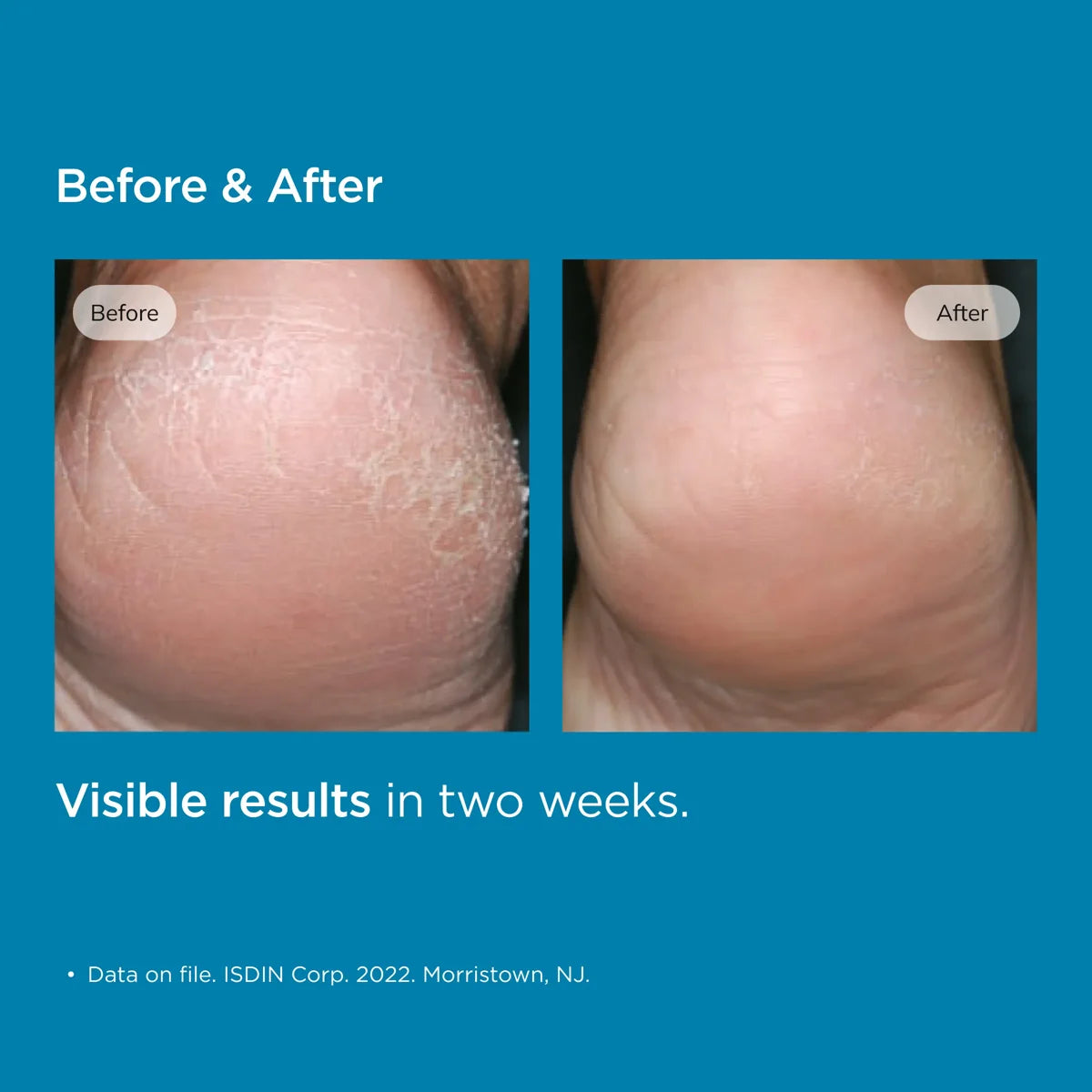 Podos Hydrating Foot Gel 2.5 Oz | 75 mL