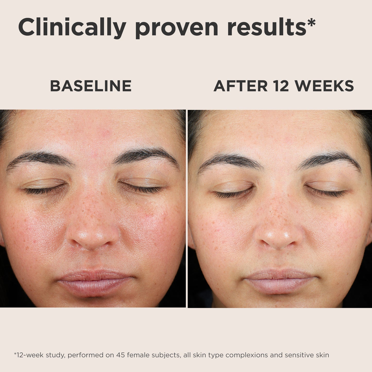 UV Skin Recovery Red Color Correcting Green Tint Broad Spectrum SPF 50