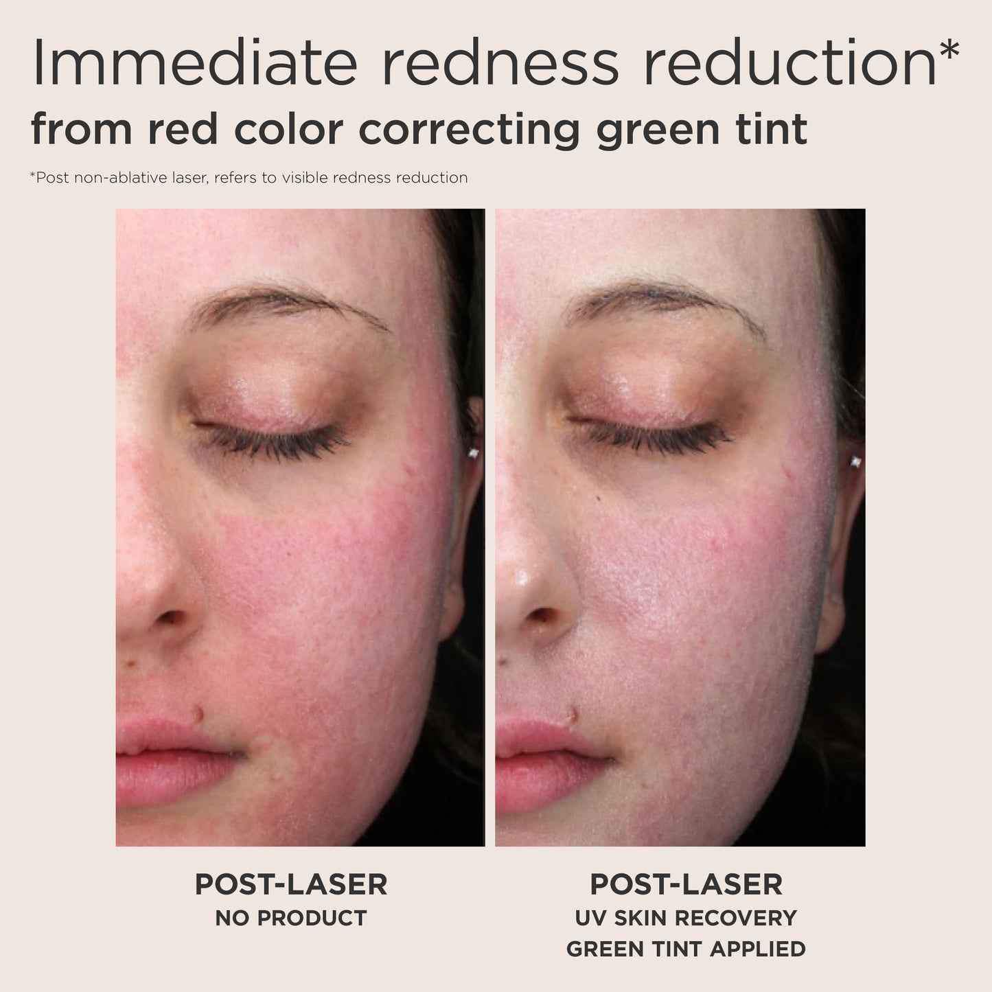 UV Skin Recovery Red Color Correcting Green Tint Broad Spectrum SPF 50